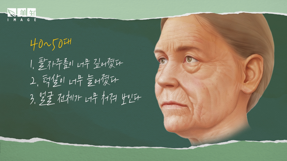 50대 안면거상술