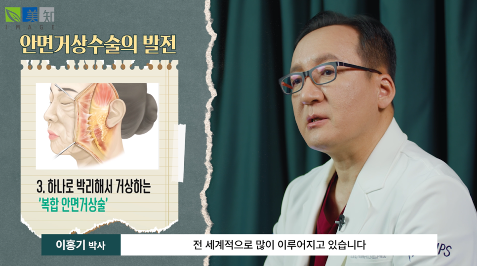 50대 안면거상술