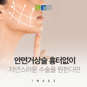 안면거상술 흉터