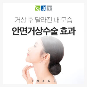 안면거상수술 효과