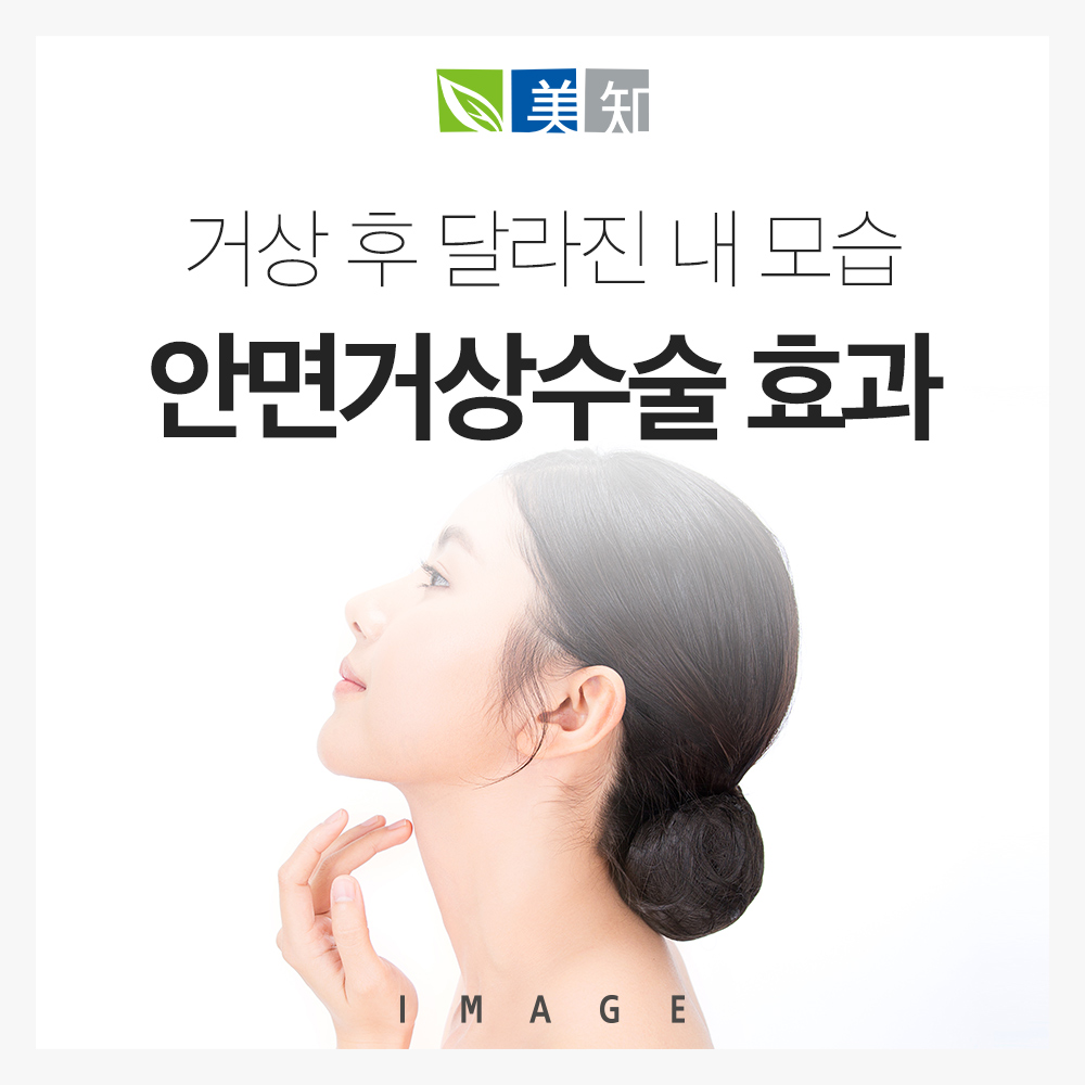 안면거상수술 효과