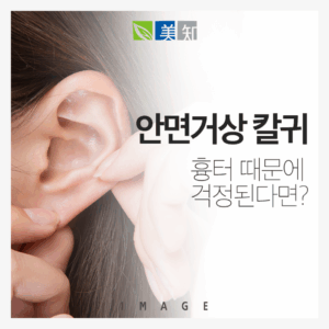 안면거상 칼귀 흉터