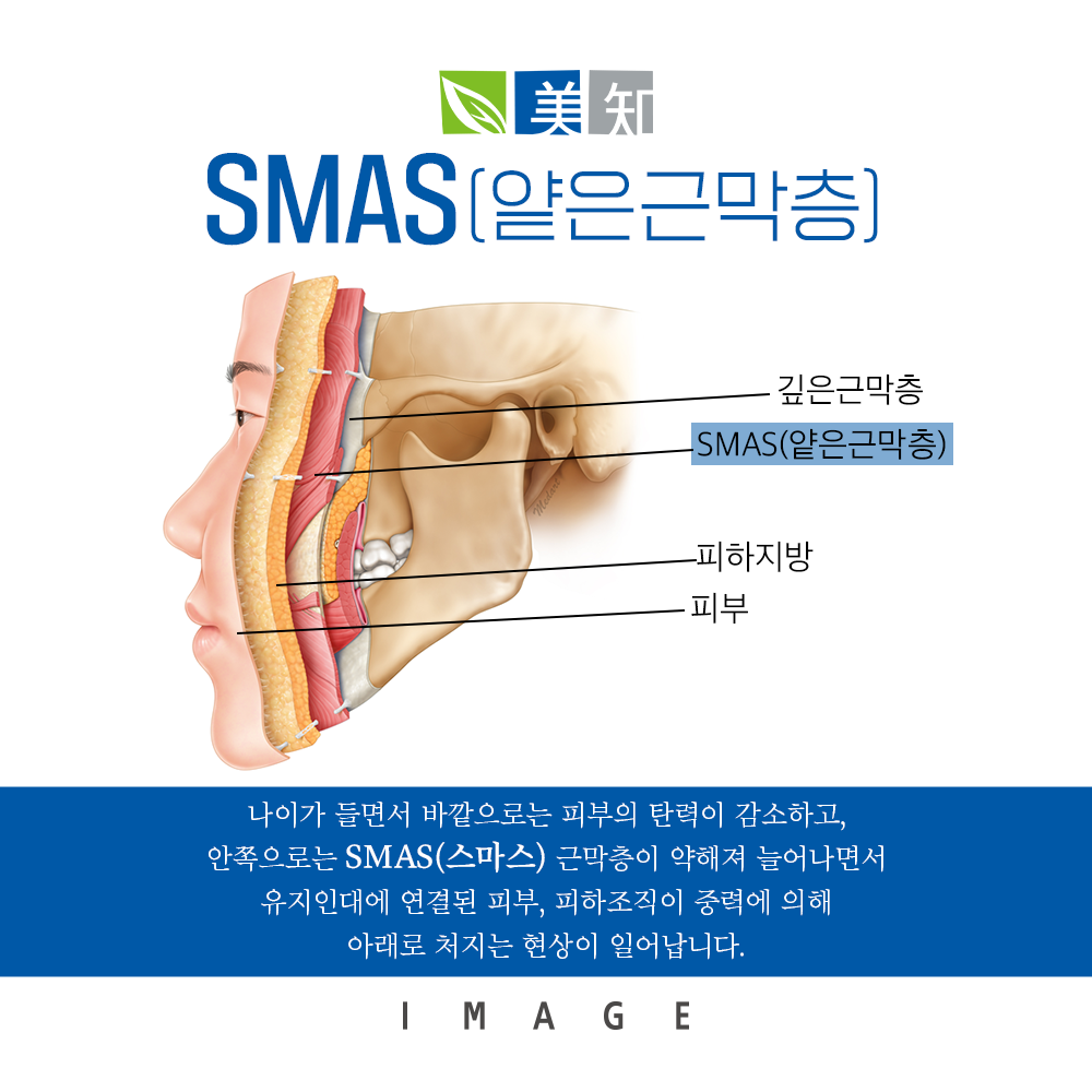 강남안면거상술