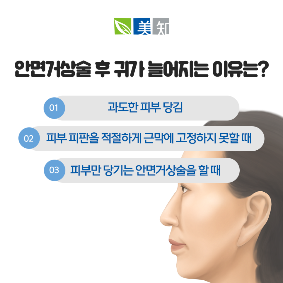 안면거상 칼귀 흉터