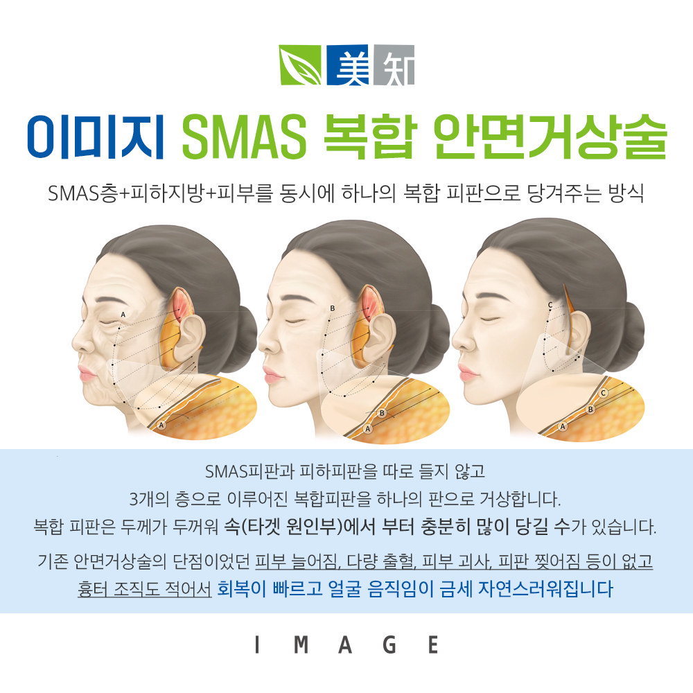 안면거상 회복기간