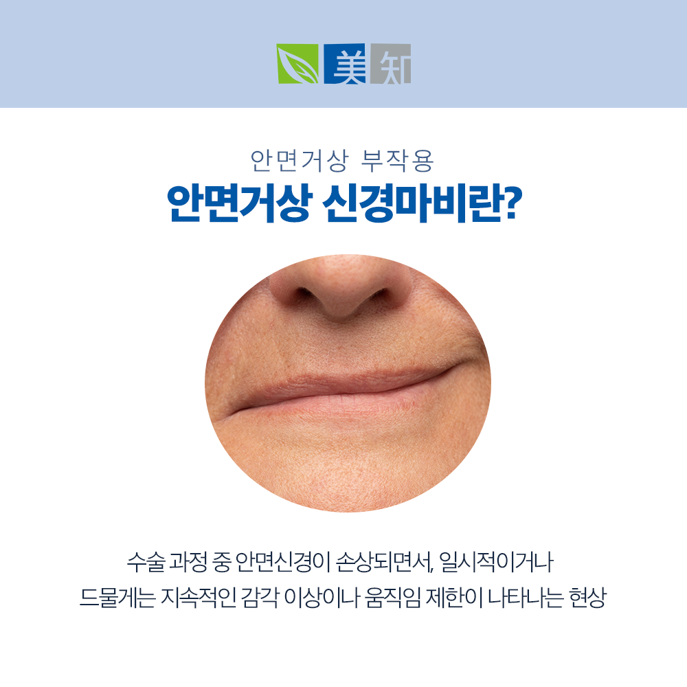 안면거상 부작용