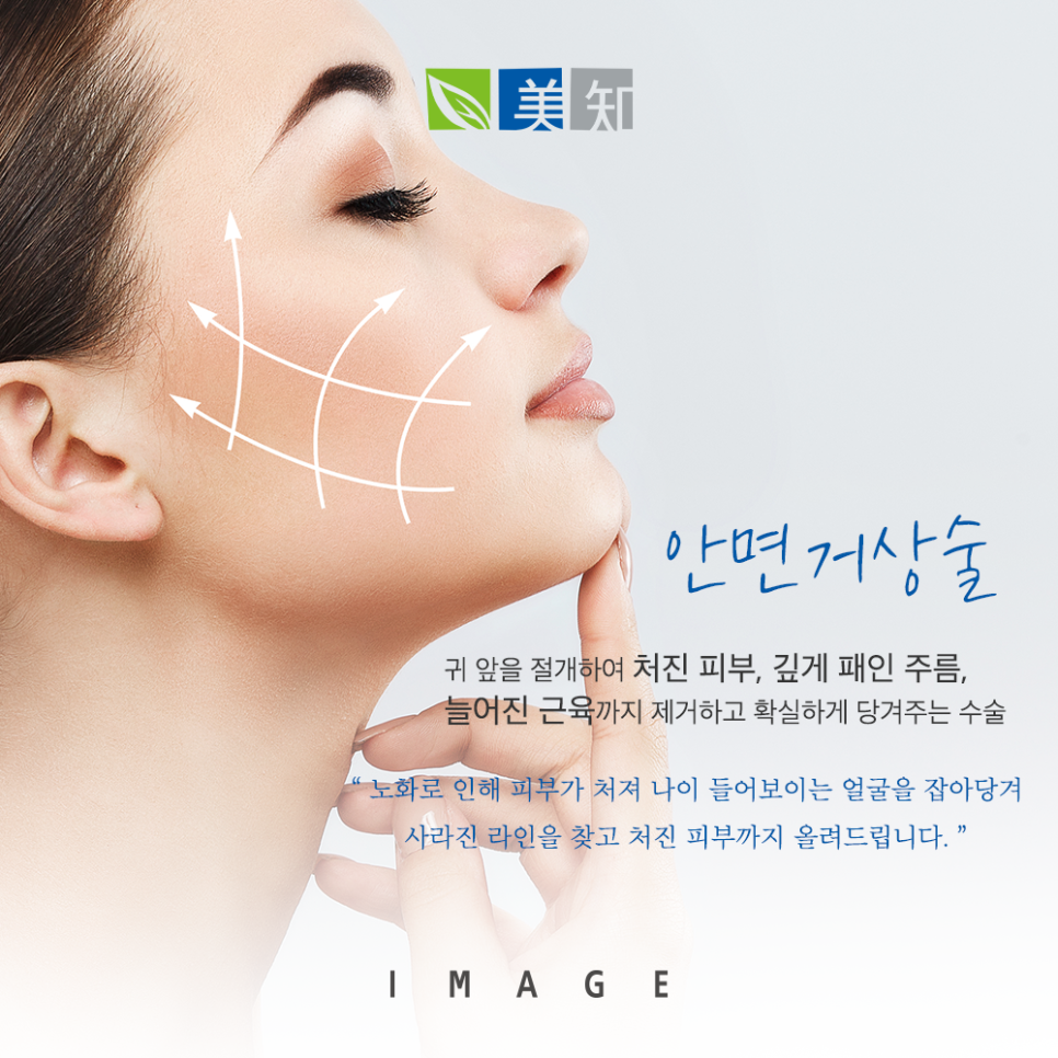 안면거상 칼귀 흉터