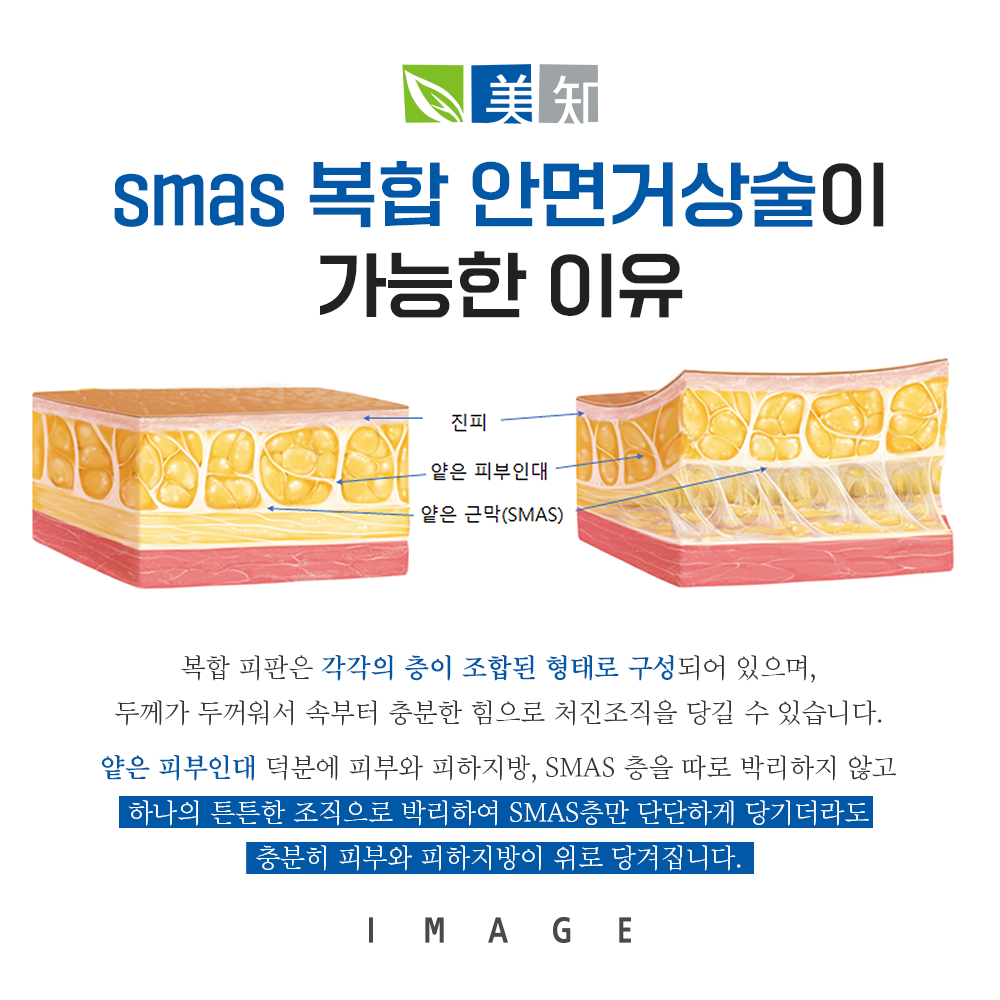 강남안면거상술