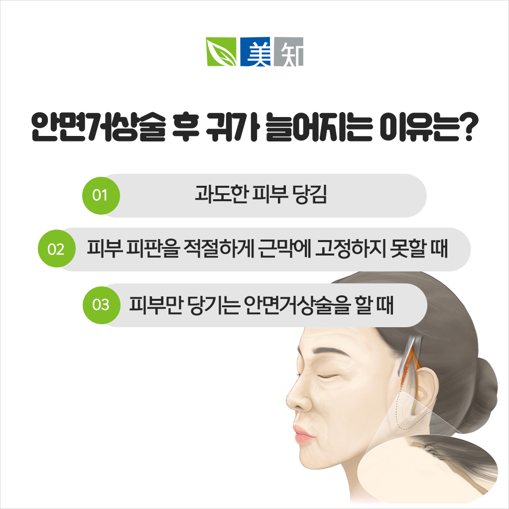 강남안면거상후칼귀