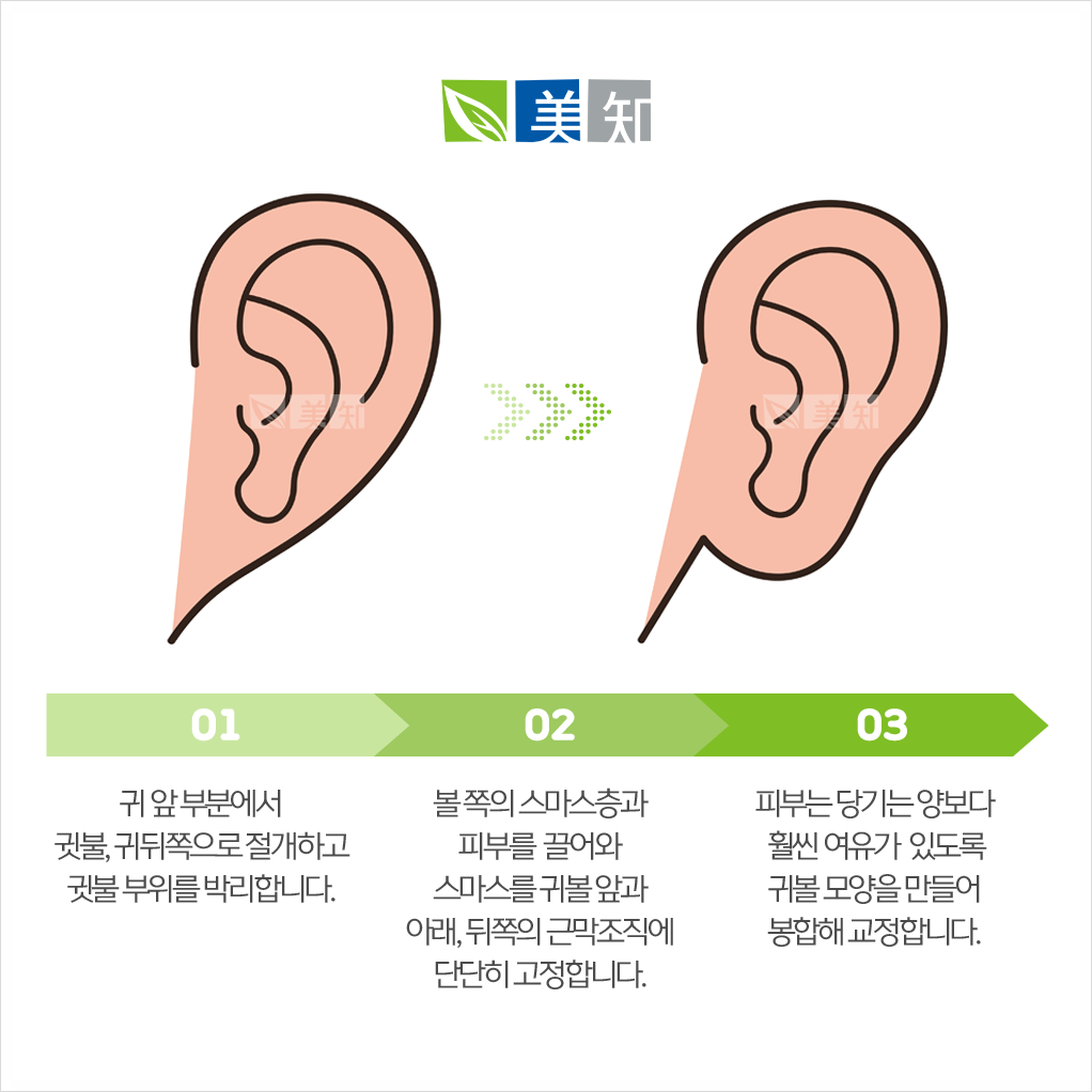 강남안면거상후칼귀