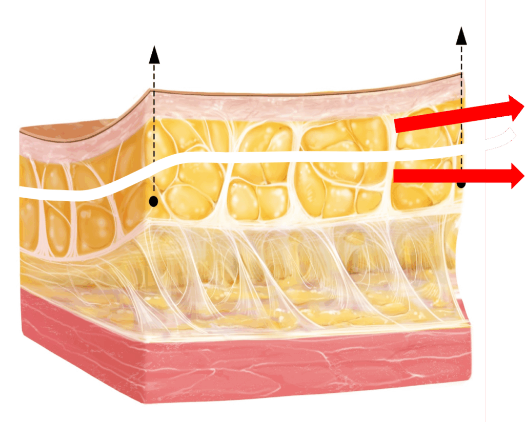 강남안면거상술