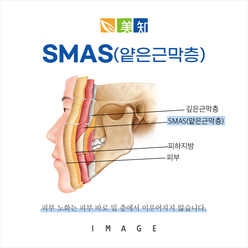 안면거상처짐