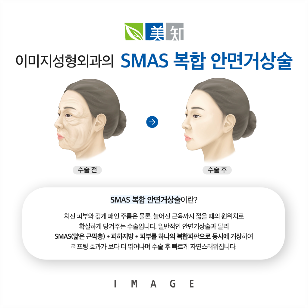 안면거상처짐