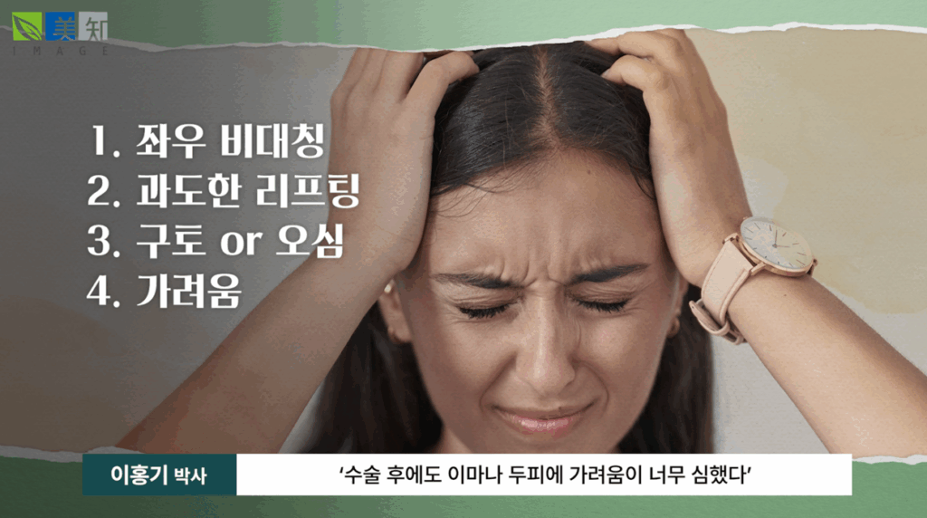 이마거상부작용