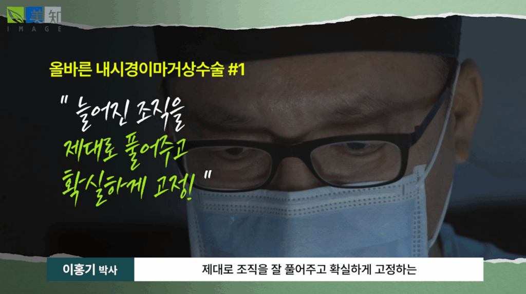 이마거상부작용