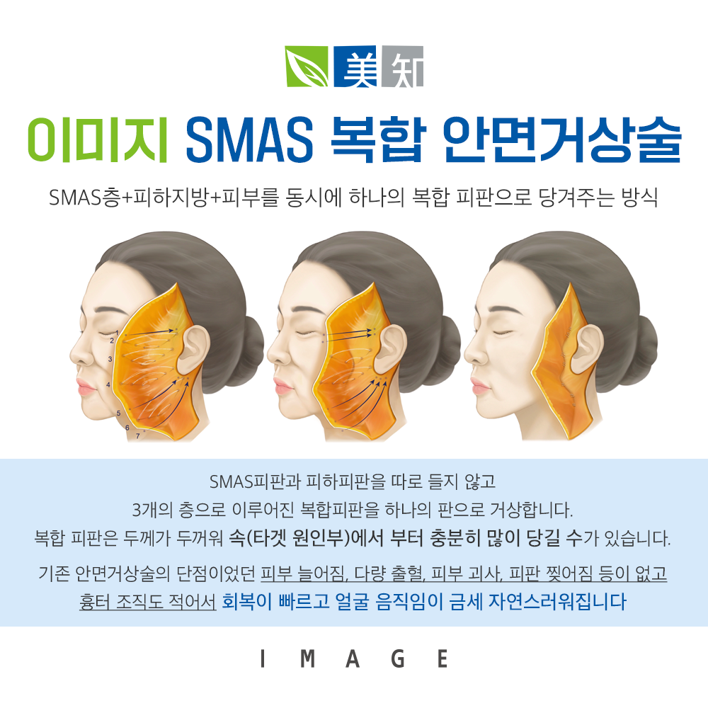 안면거상술잘하는곳