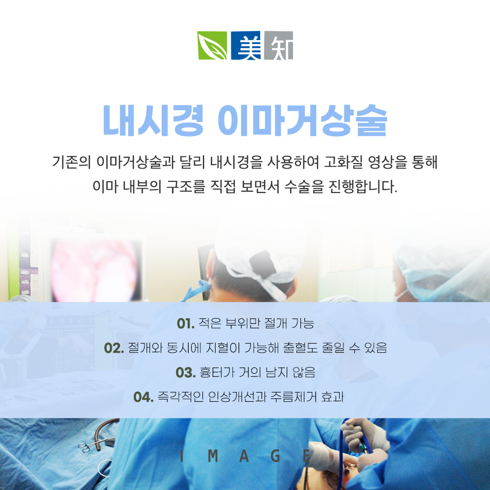 이마거상회복기간