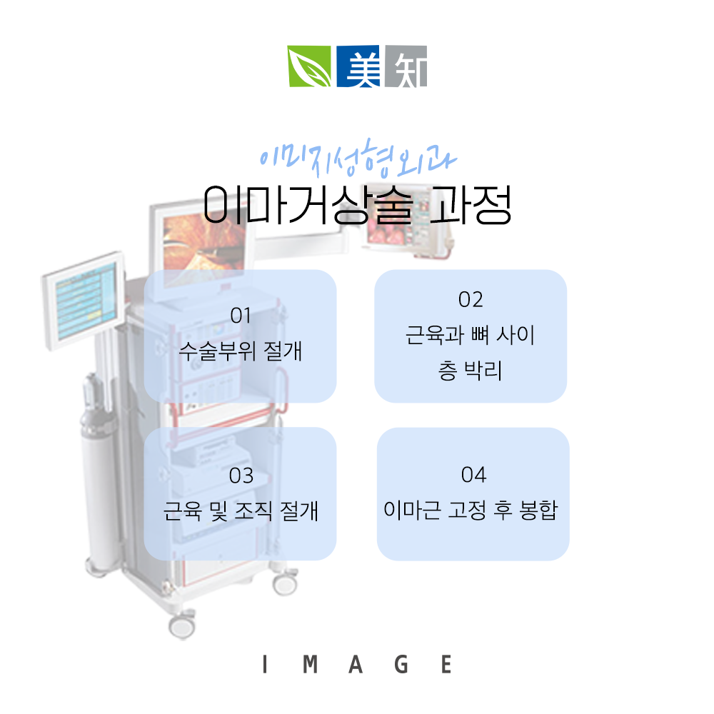이마거상회복기간