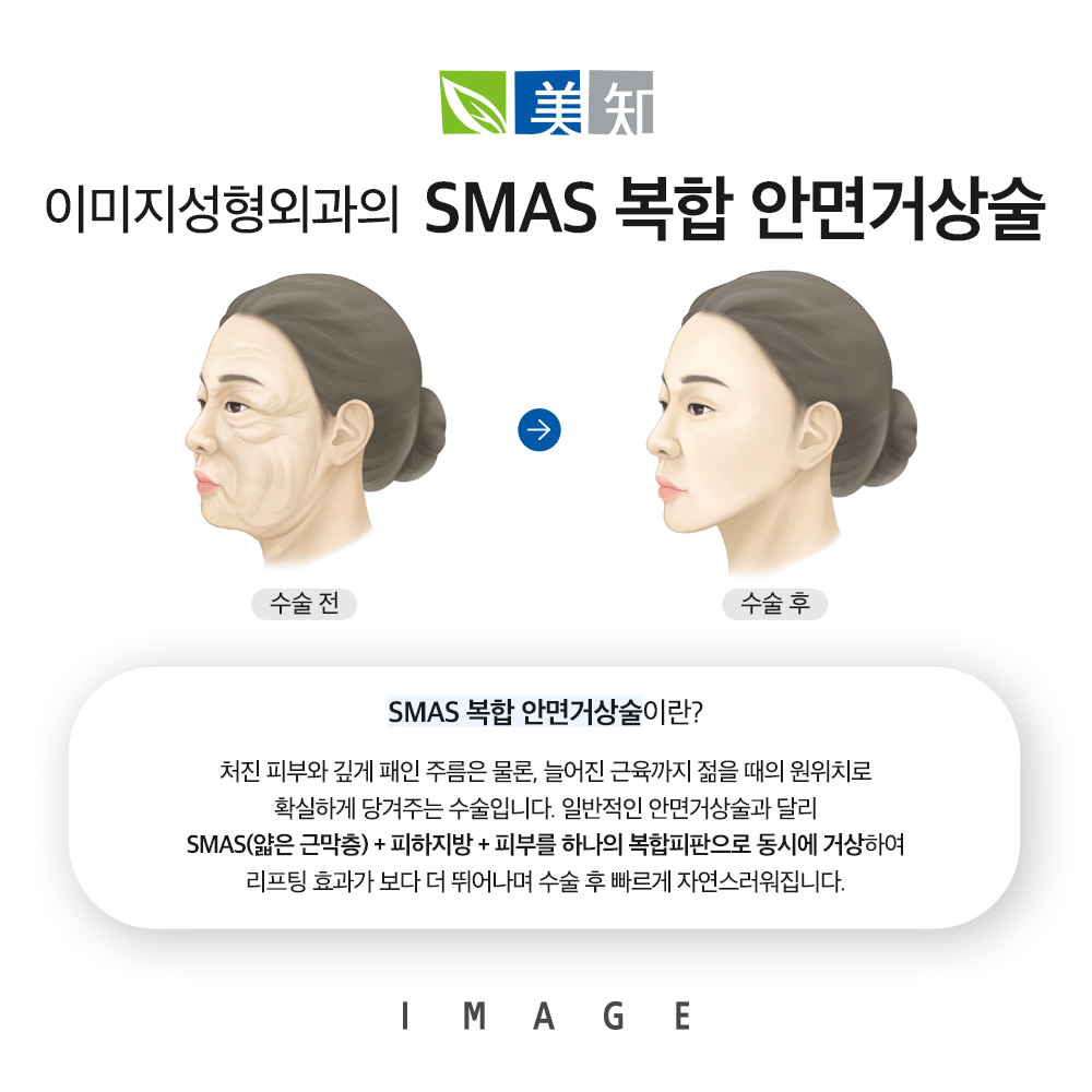 안면거상칼귀