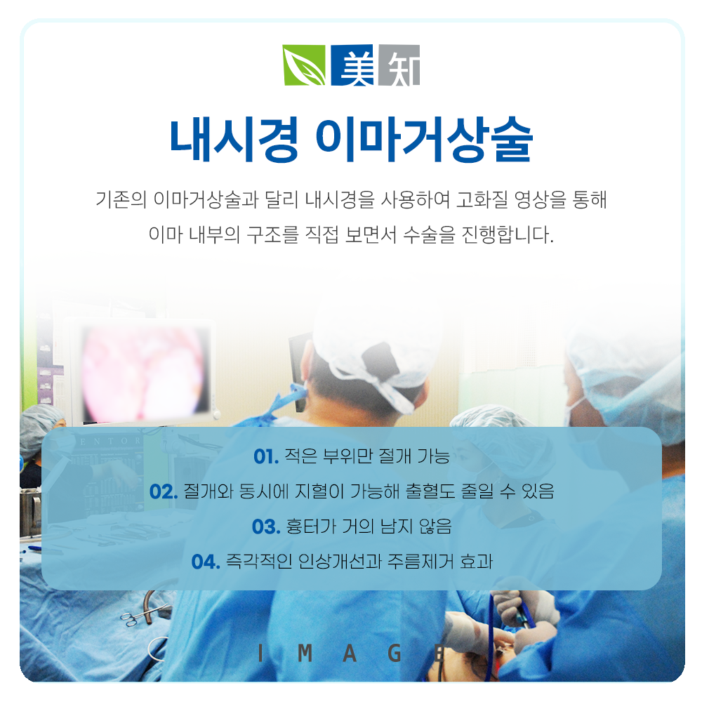 강남이마거상술
