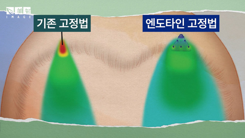 강남이마거상술