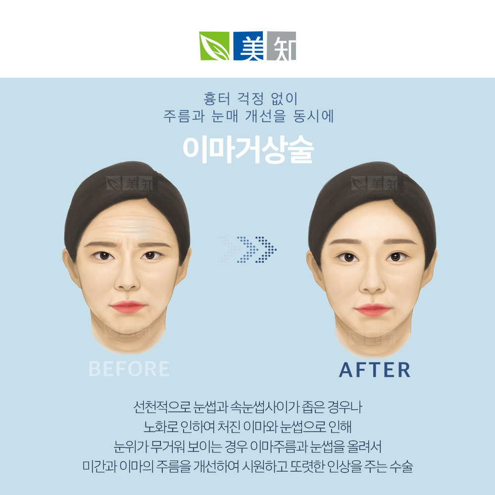 강남이마거상술