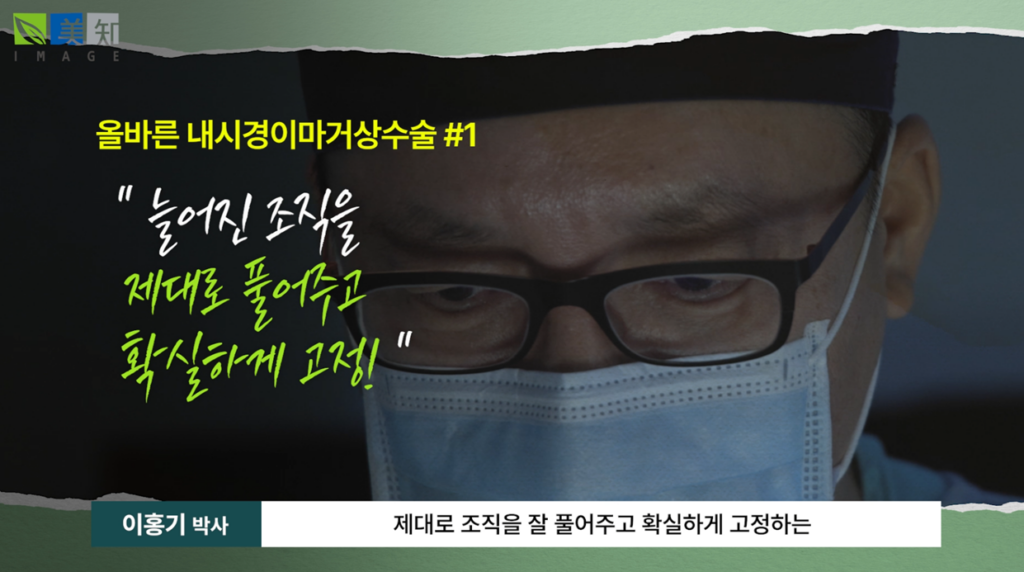 강남이마거상술