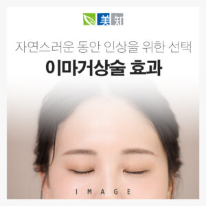 강남이마거상술