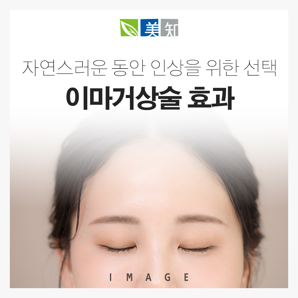 강남이마거상술