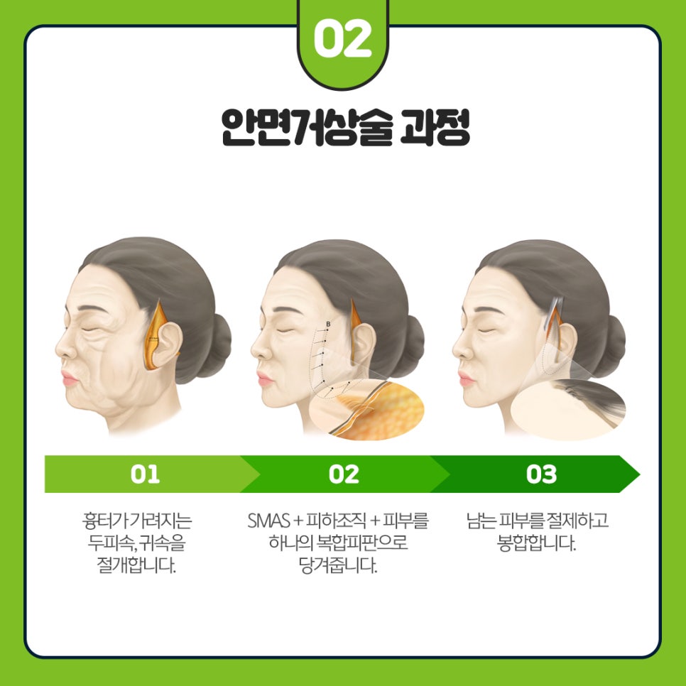 강남이마거상술