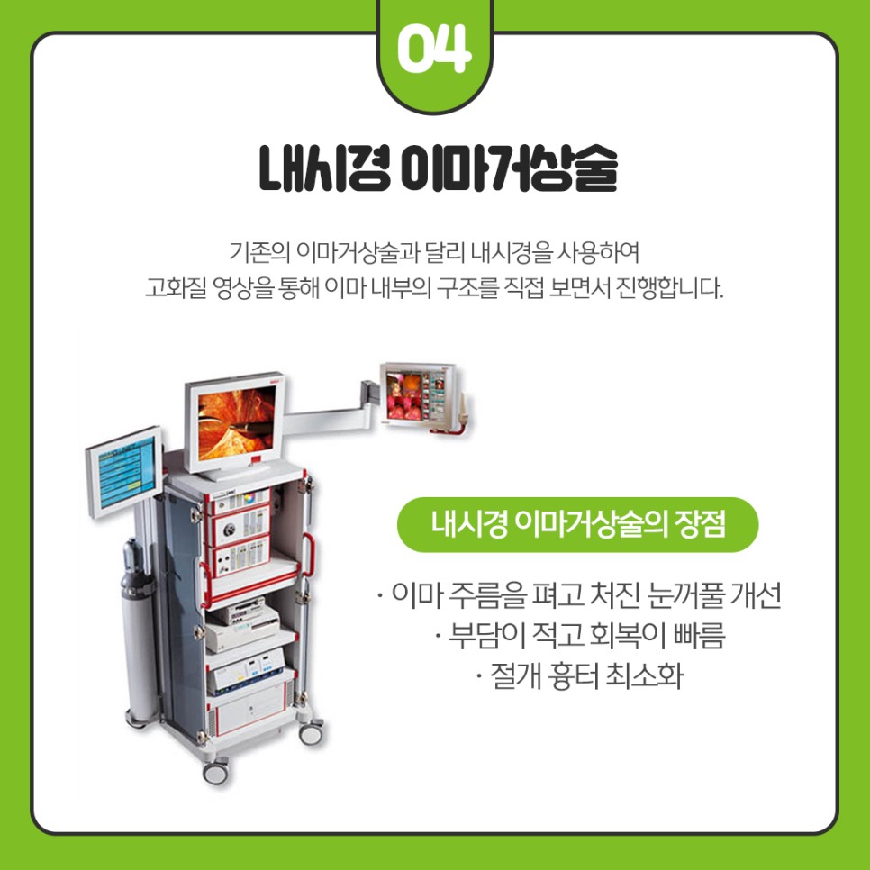 강남이마거상술