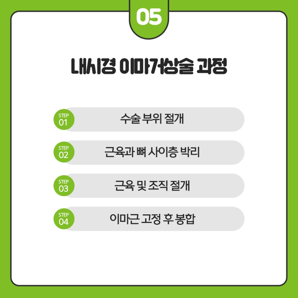 강남이마거상술