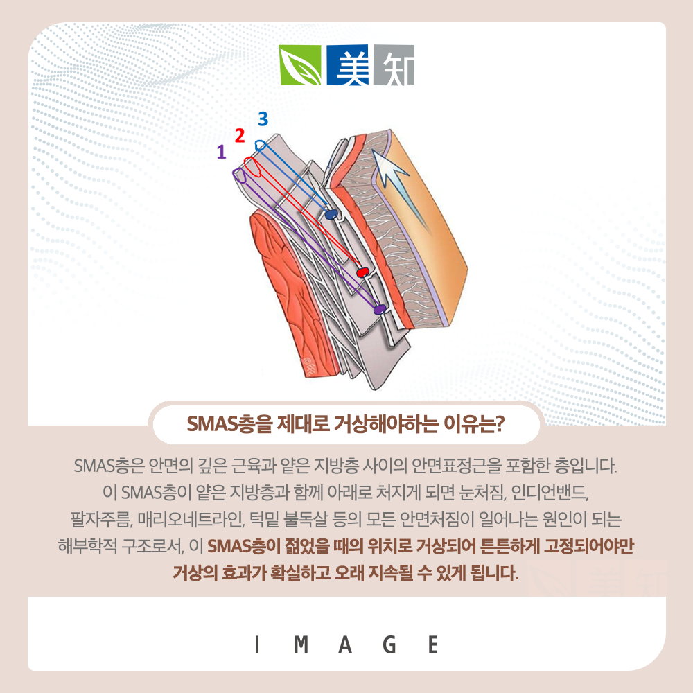안면거상회복기간