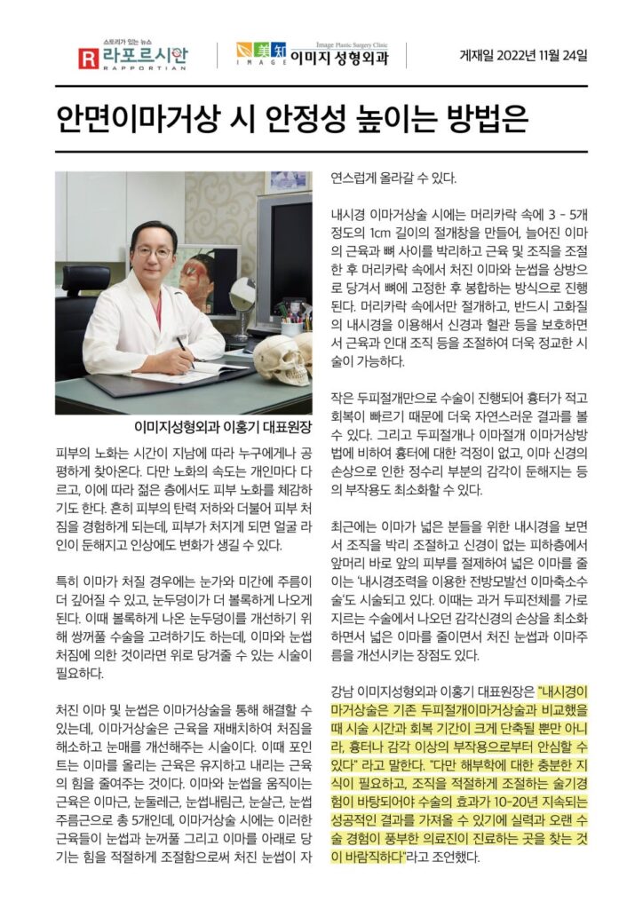 강남이마거상술