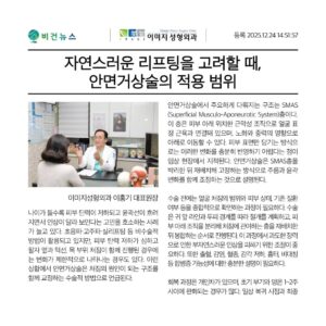 안면거상술